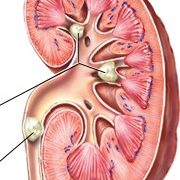 Mother of 5, Salimot Okekunle, seeks N3.5m for kidney surgery